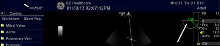 ge-logiq-s8-xdclear-display-2